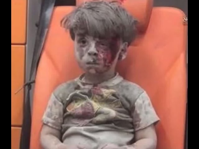 シリアの戦争を通じて心が痛みます　抱きかかえられながら救急車に乗せられた男の子　I am is painful to know this fact