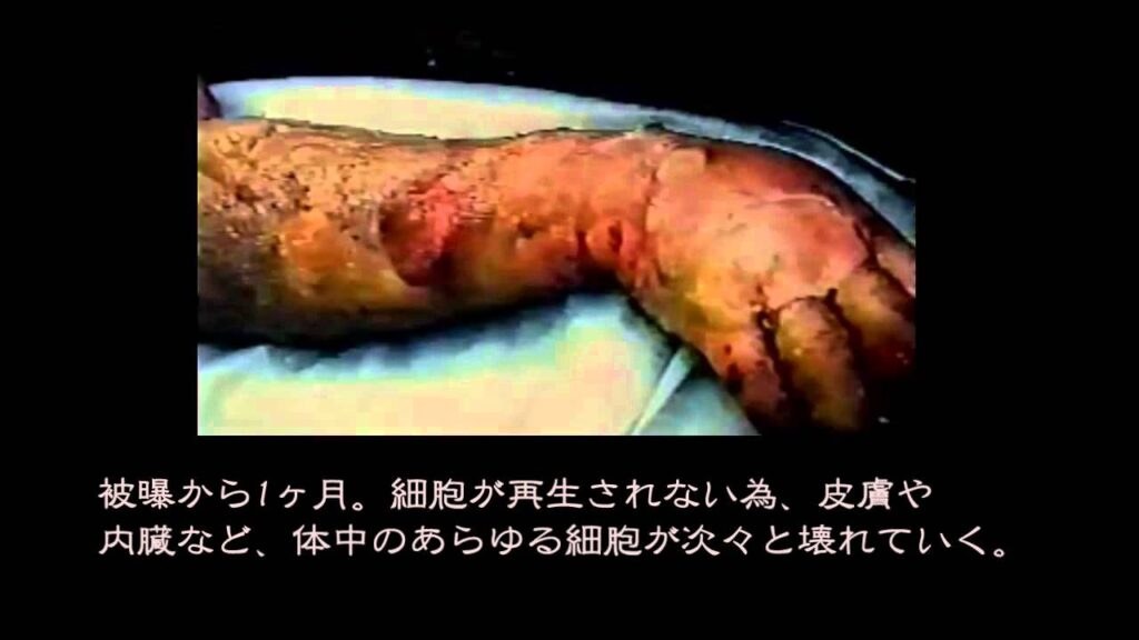 血液の闇　輸血用の赤血球はこの３倍の放射線を照射されている 　輸血製剤はなぜ危ないのか？